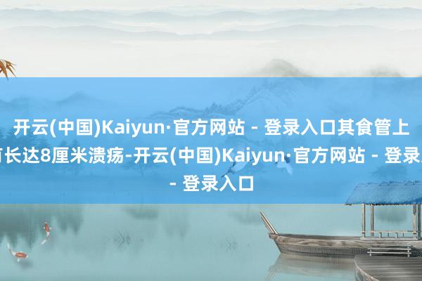 开云(中国)Kaiyun·官方网站 - 登录入口其食管上段有长达8厘米溃疡-开云(中国)Kaiyun·官方网站 - 登录入口
