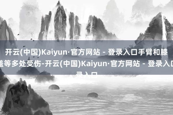 开云(中国)Kaiyun·官方网站 - 登录入口手臂和膝盖等多处受伤-开云(中国)Kaiyun·官方网站 - 登录入口